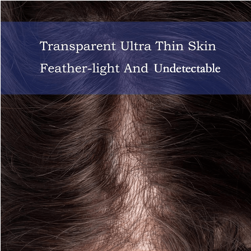 Toupet Männer Unsichtbarer Haaransatz Mit Ultradünner Haut 0,03mm Männliche Haarprothese 100% Echthaar Ersatzsystem Perücken Für Männer