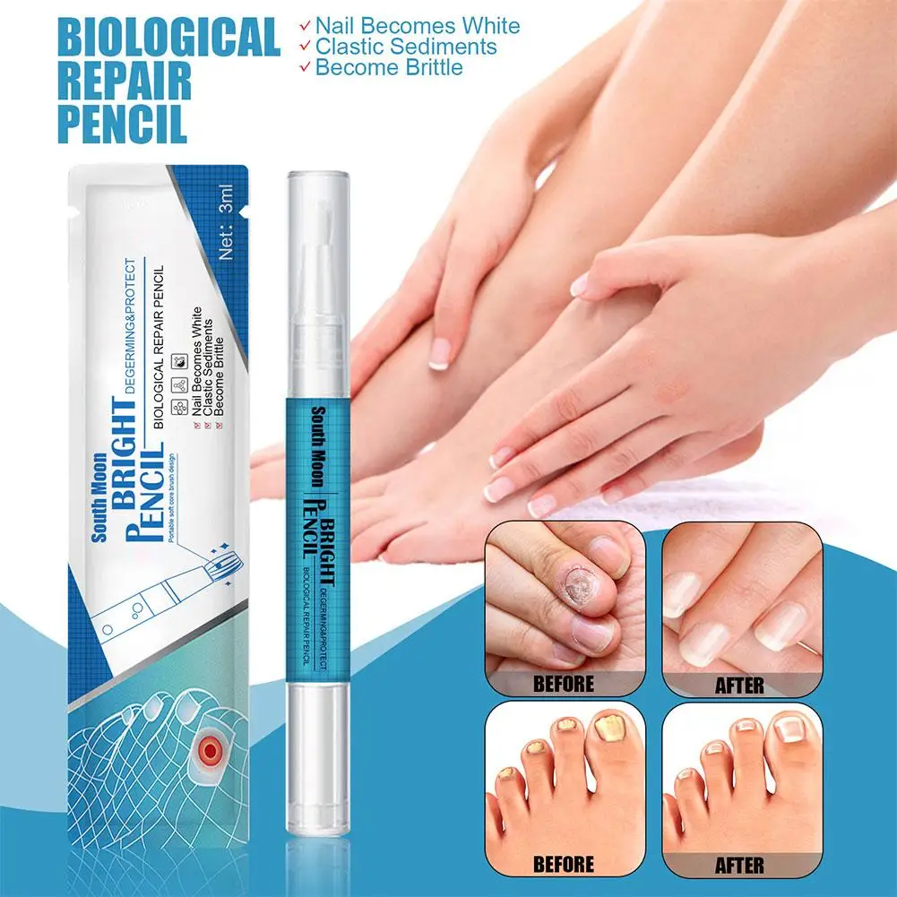 Pluma líquida para reparación de uñas, suero para tratamiento de hongos en las uñas, crema para los dedos de los pies, Gel antieliminación, reparación de hongos en los pies, infección líquida F4I6, 3 ML