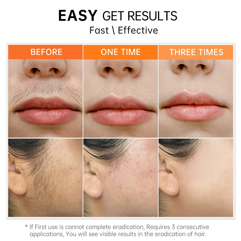 Женская/Мужская эпиляция для лица и подмышек