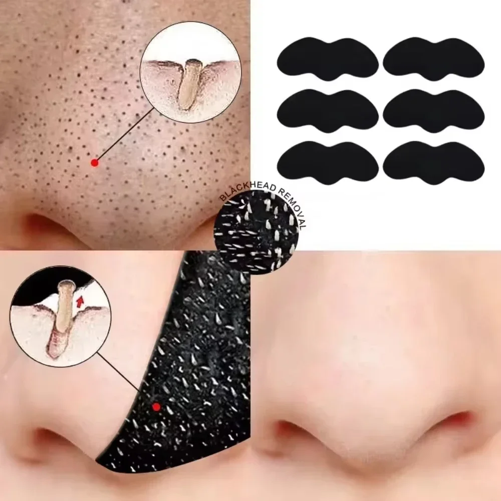 Tiras nasales de limpieza profunda Unisex para eliminación de acné y espinillas, pegatinas de cabeza negra para reducir los poros y la nariz, parche refrescante para el cuidado de la piel