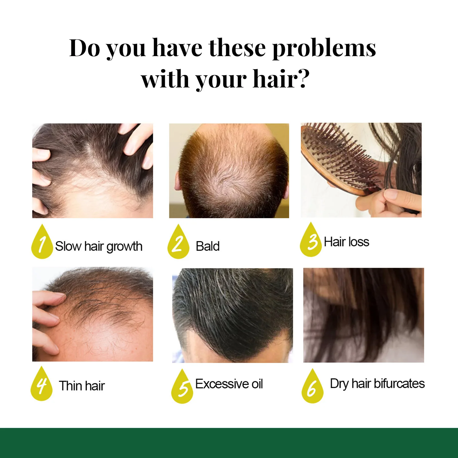 EELHOE 育毛スプレー 7 日間ジンジャーセラム頭皮ダメージ治療脱毛防止効果的な高速成長マッサージ液体 50 ミリリットル