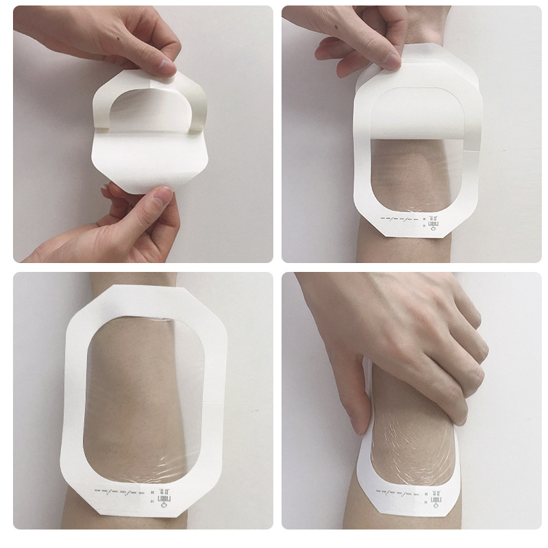 50Pcs Medical Waterproof Wound Dressing PU Film Breathable Sterile PICC I.V. Cannula Infusion Indwelling Needle Fixation Sticker