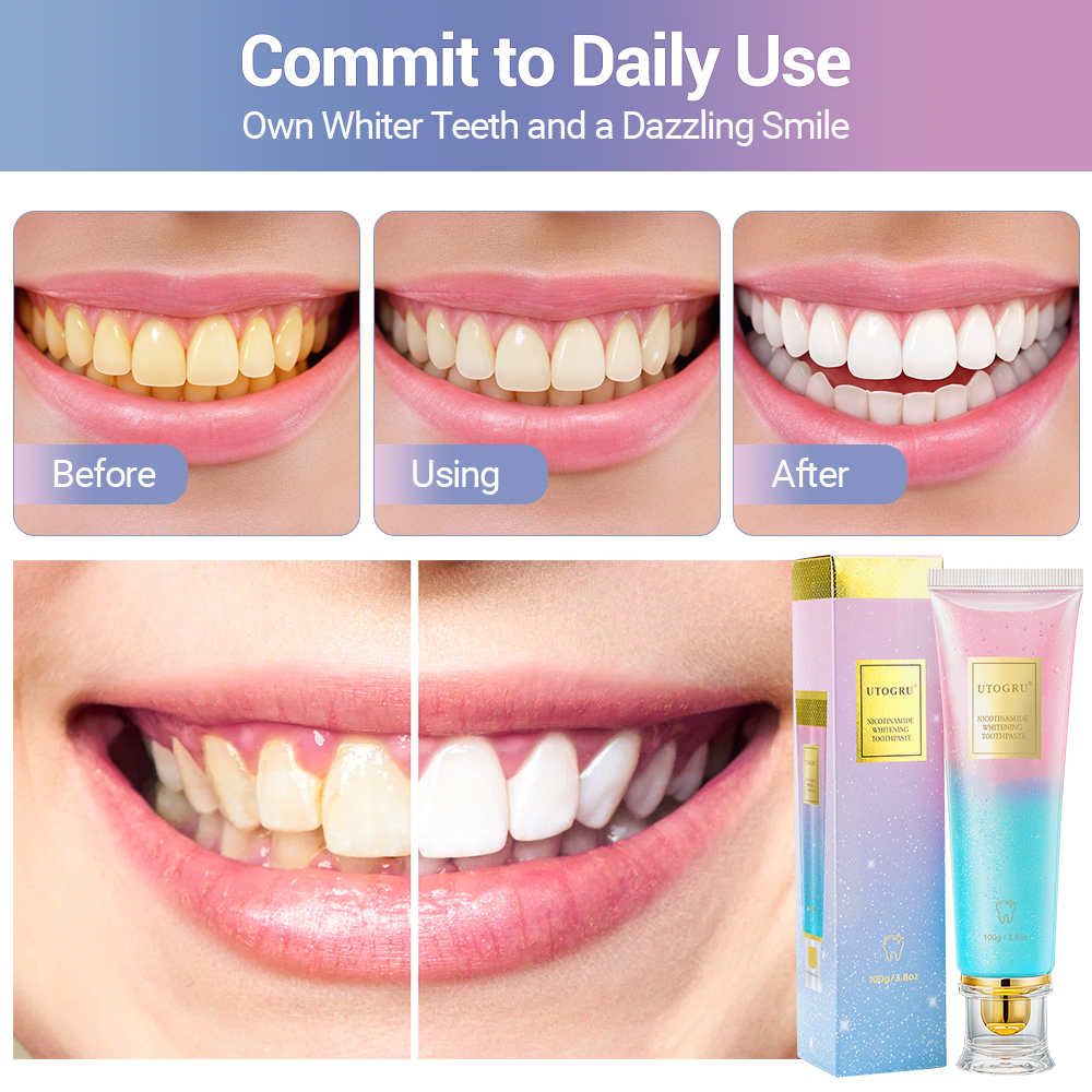 100g Niacinamide Whitening Toothpaste Refreshing Clean Teeth For Men And Women Fresh Breath Toothpaste To Remove Tooth Stains