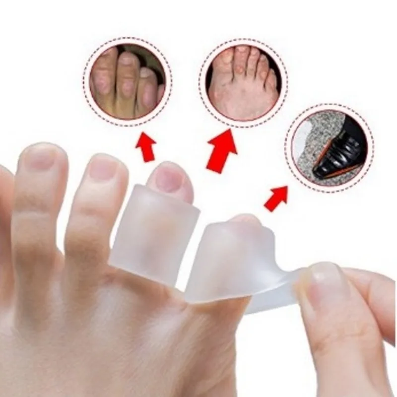 6 Chiếc/3 Đôi Gel Silicone Nhỏ Mũi Ống Xác Thối Vỉ Corrector Pinkie Tấm Bảo Vệ Gel Bunion Tay Ngón Chân Xương nẹp Hỗ Trợ