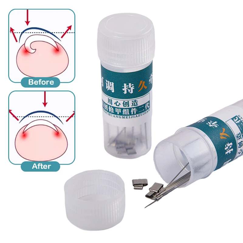 Corrector de uñas encarnadas, herramientas para pedicura, recuperación integrada, tratamiento de uñas de los pies, soporte profesional para alisar uñas encarnadas