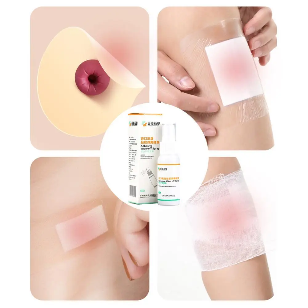 Colostomy 접착제 닦기 스프레이, 의료 접착제 제거제, Ostomy 가방 관리 제품, 30ml