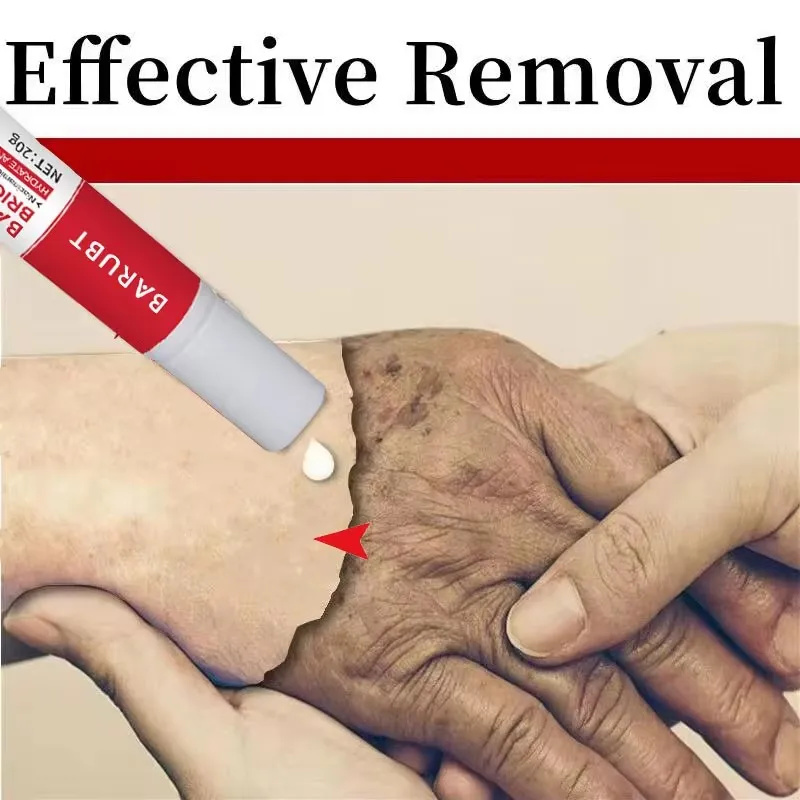 ไวท์เทนนิ่งกระครีมกําจัดฝ้าจุดด่างดํา Corrector Lighten เมลานินสีกระจ่างใส Anti-Aging Beauty Care