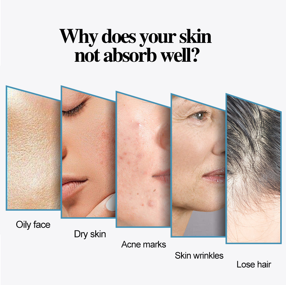 Hydra Meso Pen-Patronennadel, 9, 12, 36 42, runde 3D-5D-Mikronadel mit Spritze für Mesotherapie-Stift, Gesichts-Hydratations-Lifting