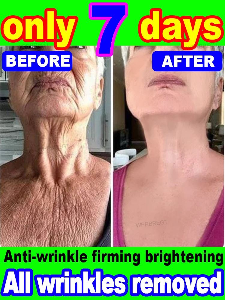 20-летний младший, 100% морщины исчезают