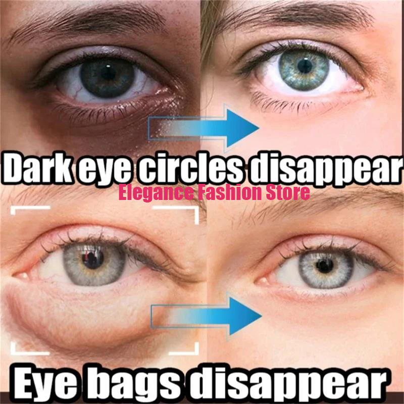 Bolsa de ojos instantánea, crema para eliminar los ojos, partículas antigras, ojeras, hinchazón, decoloración de líneas finas, brillo, belleza coreana, cuidado de los ojos