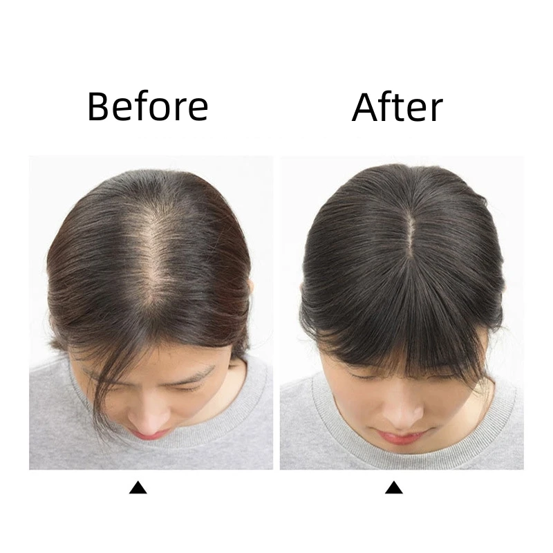 Toppers de cabelo humano de renda slik t-parte para mulheres clip-in topper com franja de ar 3d postiços para mulheres desbaste perda de cabelo