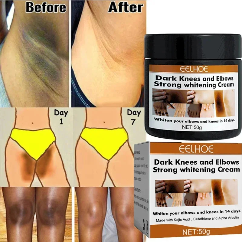 Crema para blanquear el cuerpo, partes privadas, suero blanqueador de axilas, blanqueador de glúteos, rodilla, ilumina la parte interna del muslo, íntimo, oscuro, elimina la melanina