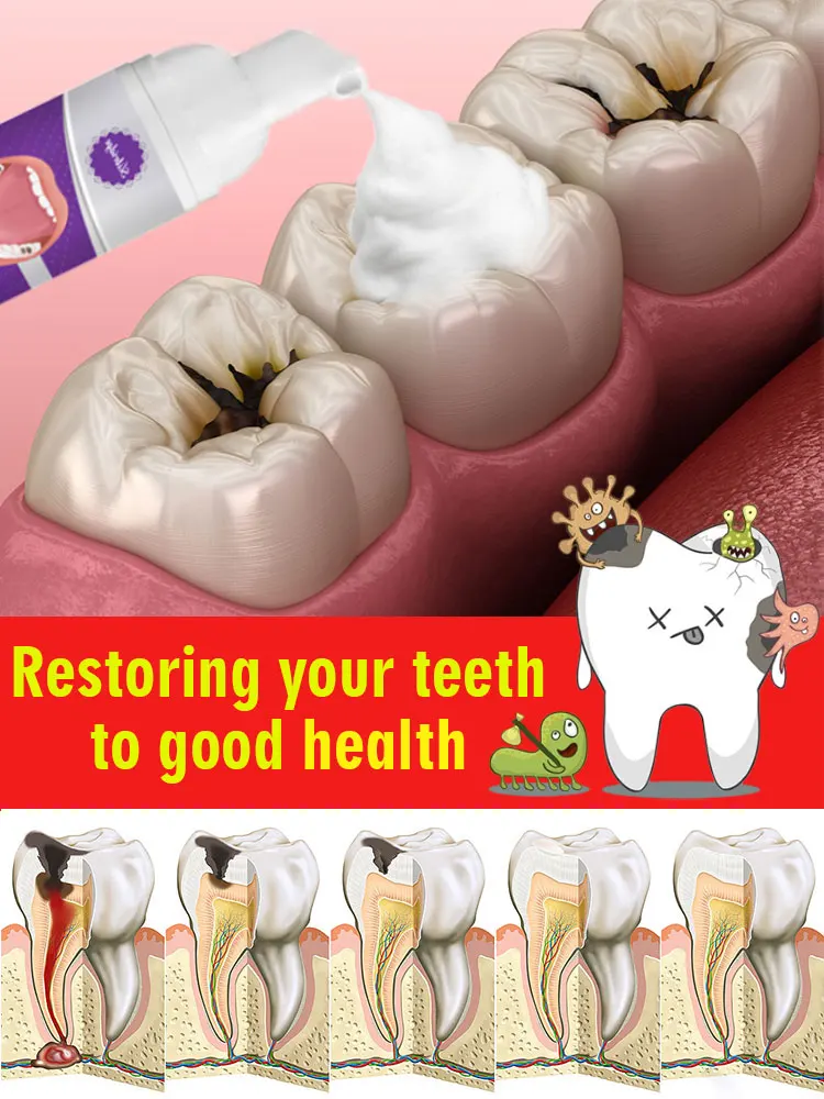 Solve all dental problems
