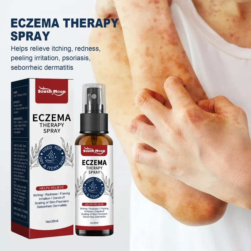 Спрей от экземы, красная сыпь, крем от псориаза, лечение рук, тинея, ног, Versicolor, ингибитор дерматита, грибка, уход за кожей против зуда