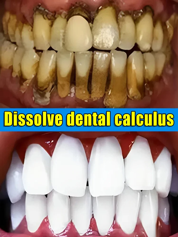 Resuelve problemas dentales