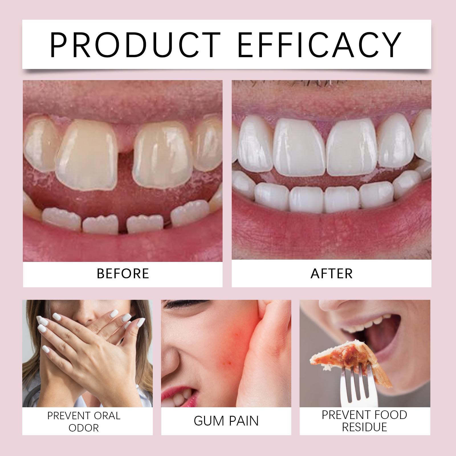 Denture Fixing Adhesive Cream Strong Complete Professional Dentures Glue Prevents Denture Loosening Care Fixed Adhesive 28g