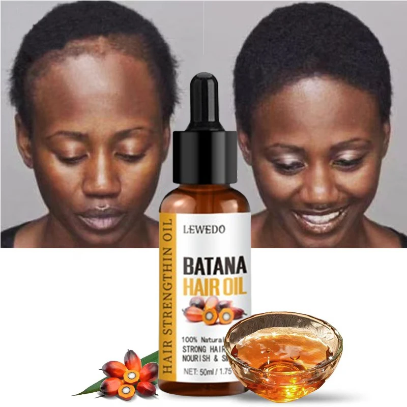 Lewedo Naturals Batana Olie Snelle Haargroei voor Mannen Vrouwen Pure Batana Olie Voeden Glanzend Haar Gezonde Haarverzorging Anti Haaruitval