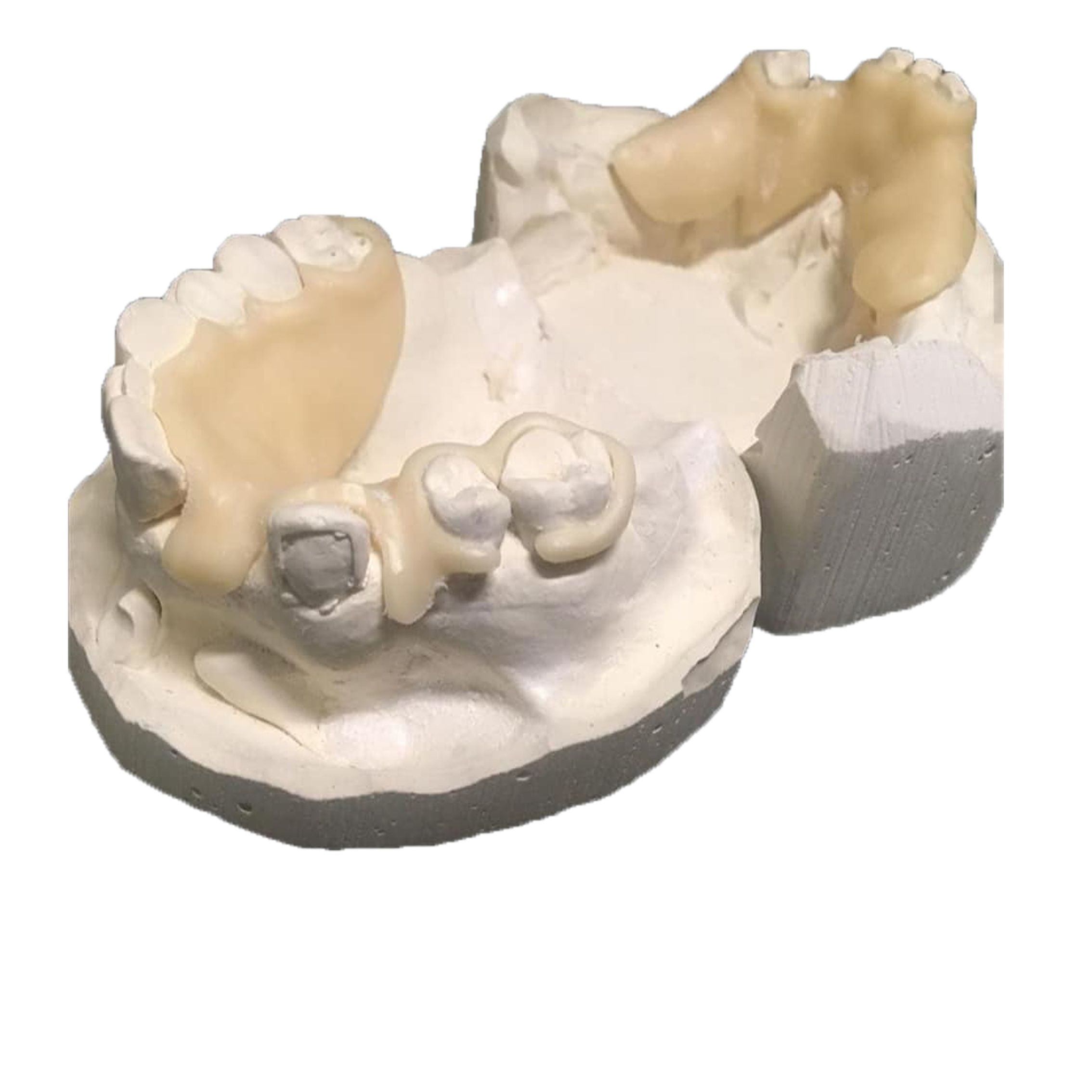 Green PMMA 5 buah ZZ9518mm monokrom Zirkonzahn CAD CAM Resin Disc -Dental Lab bahan gigi putih