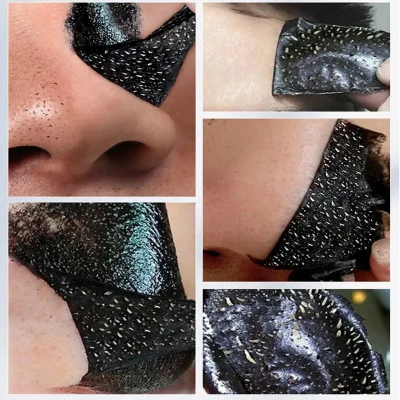 LANBENA にきび除去マスク毛穴縮小ディープクリーニングマスク肌荒れ改善ニキビ治療肌の美白ケア美容