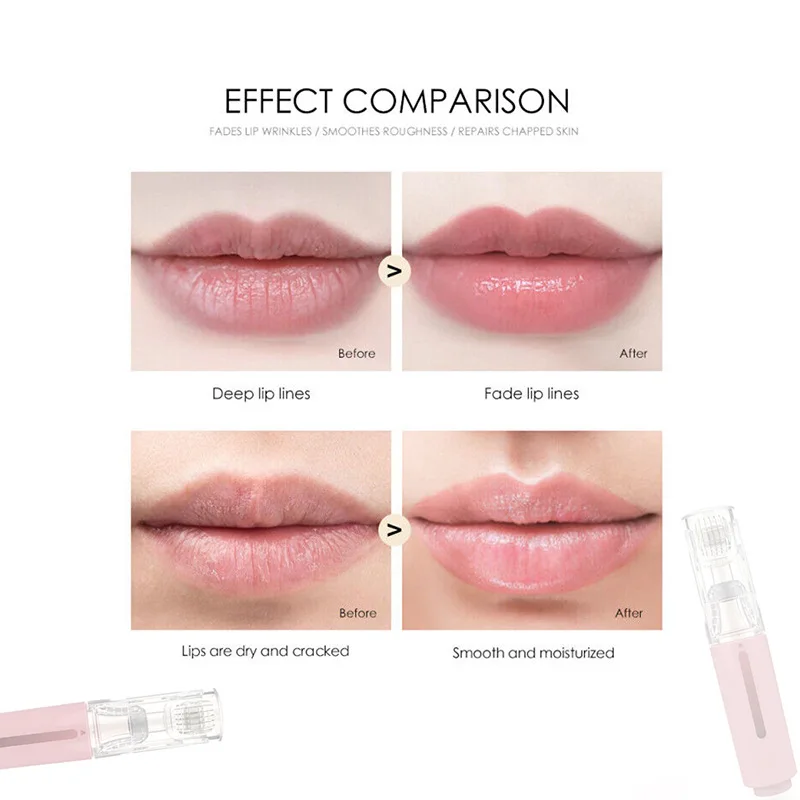Derma Roller Titan Nadelroller, Lippenroller, Bartwachstumsroller, Barthaarwachstumsroller, Bartbehandlung und Serumapplikation