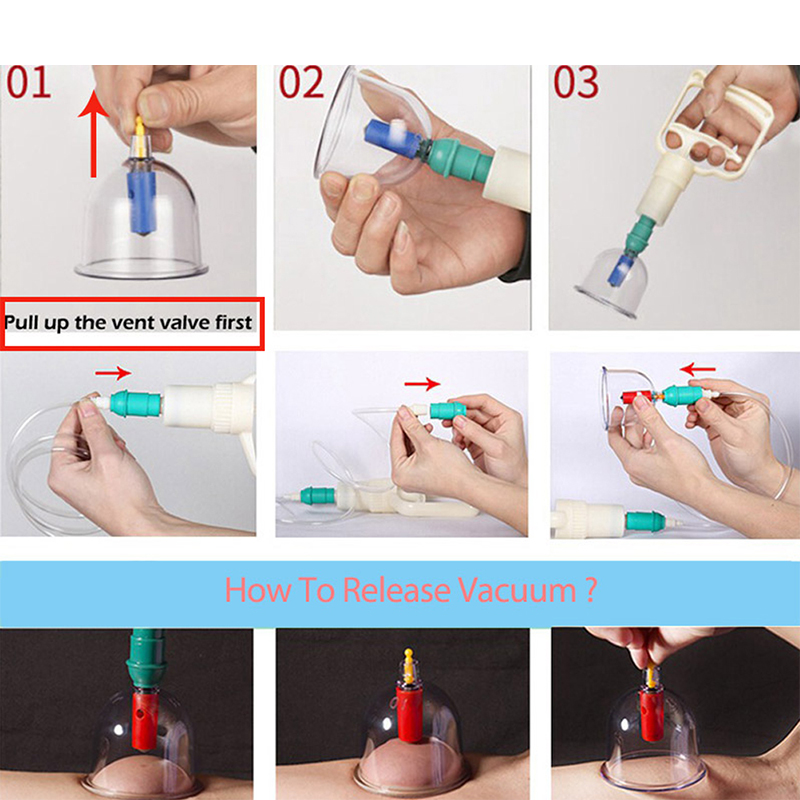 1pcs Cupping ชุด Professional จีน Acupoint Cupping Therapy ชุดดูด Hijama Cupping ชุดสูญญากาศแม่เหล็กปั๊ม