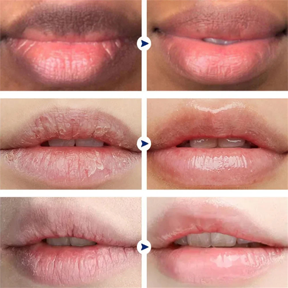 Quitar humo oscuro bálsamo labial aclarador melanina blanqueamiento brillo aceite labios lápiz labial rosa exfoliante desvanecimiento líneas de labios cosméticos Coreanos