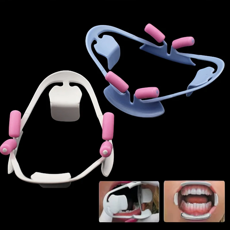 Dental otwieracz do ust 3D policzek ustny zwijacz ust ortodontyczny profesjonalny dentysta ekspander zębów sprzęt laboratorium dentystycznego materiały