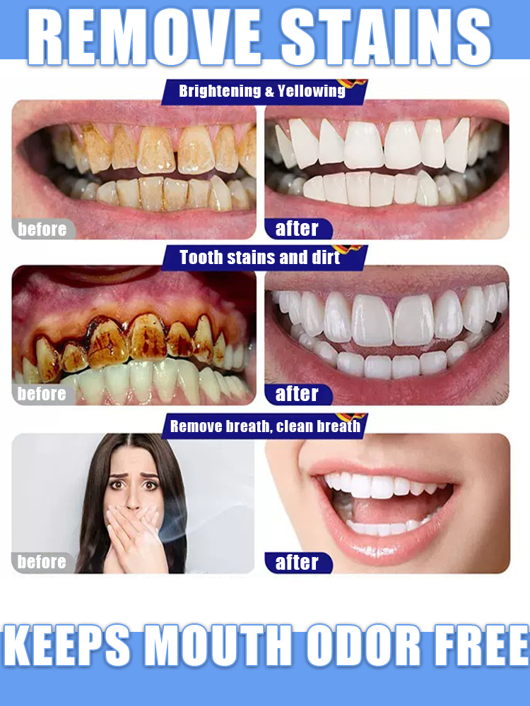 Sbiancamento dei denti, ripristino rapido e naturale delle gengive, recensioni degli utenti estremamente positive