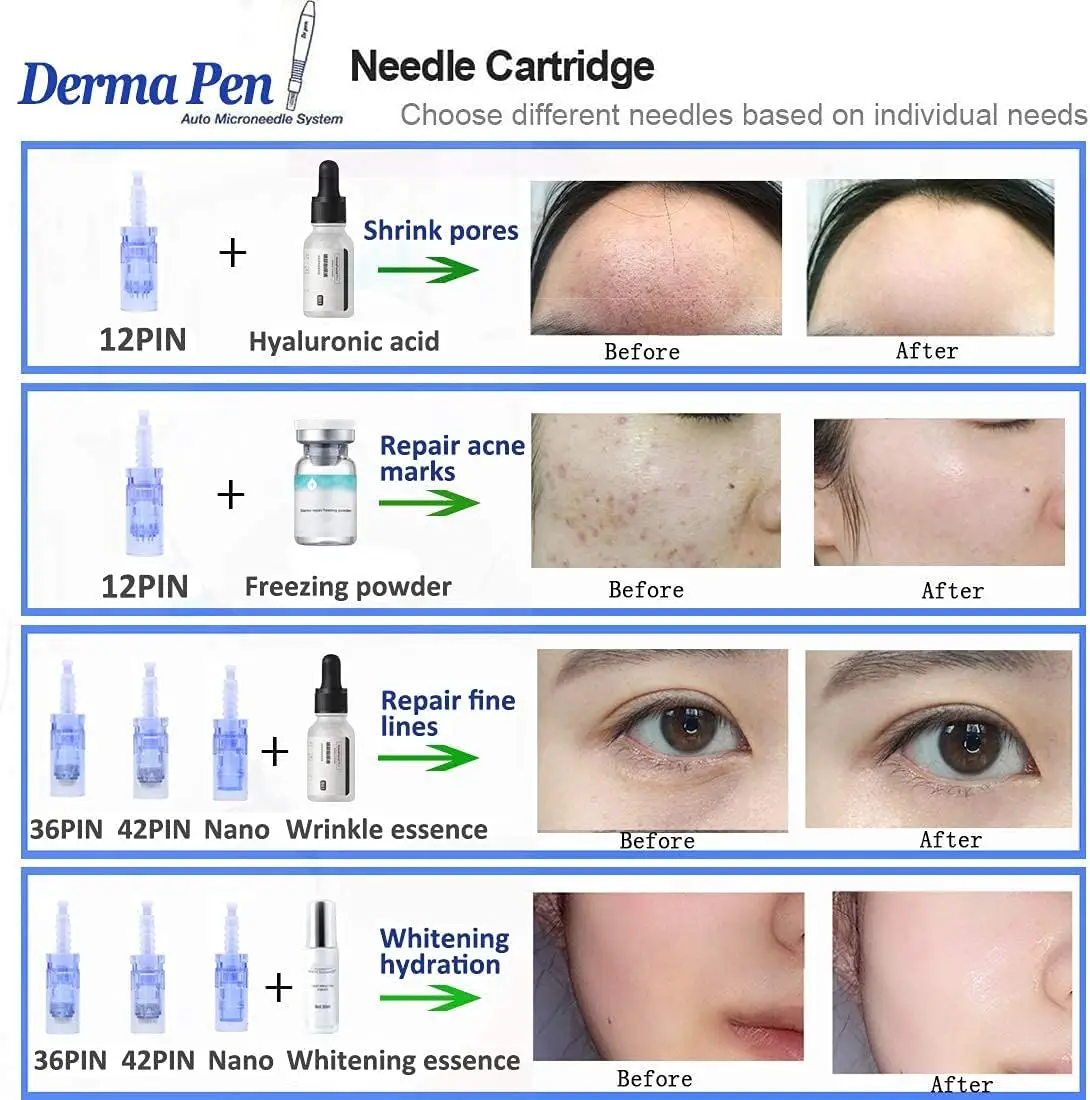 Ultima DR A6ปากกาของแท้พร้อมตลับหมึก6ชิ้นชุดกล่องเครื่องมือดูแลผิวระบบไฟฟ้าไร้สายภายในบ้านเครื่องความงามผิวหน้าอัตโนมัติ