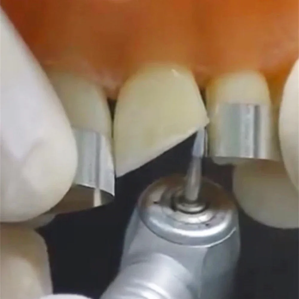 1pc dental tiras de matriz de aço inoxidável filme de resina restauração luz curada resina clara matriz bandas polimento tira material
