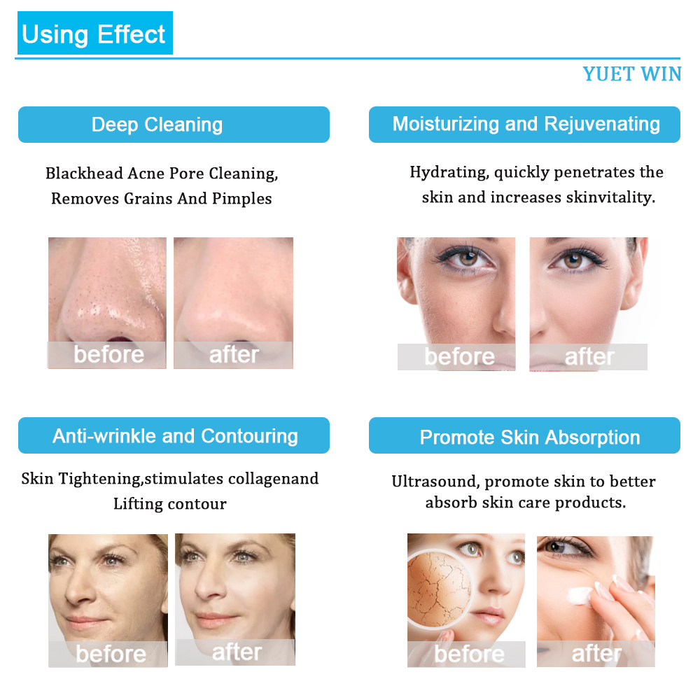 7 in 1プロフェッショナルウォーターダーマブレーションフェイシャルマシンディープクレンジング,リフティングスキンスクラバー,アクアピーリング,スパ美容機器