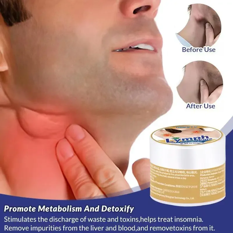 Pomada de dragado linfático, linfa auxiliar para el cuello y el pecho, glándula mamaria, tratamiento, crema de desintoxicación, yeso de moxibustión caliente a base de hierbas