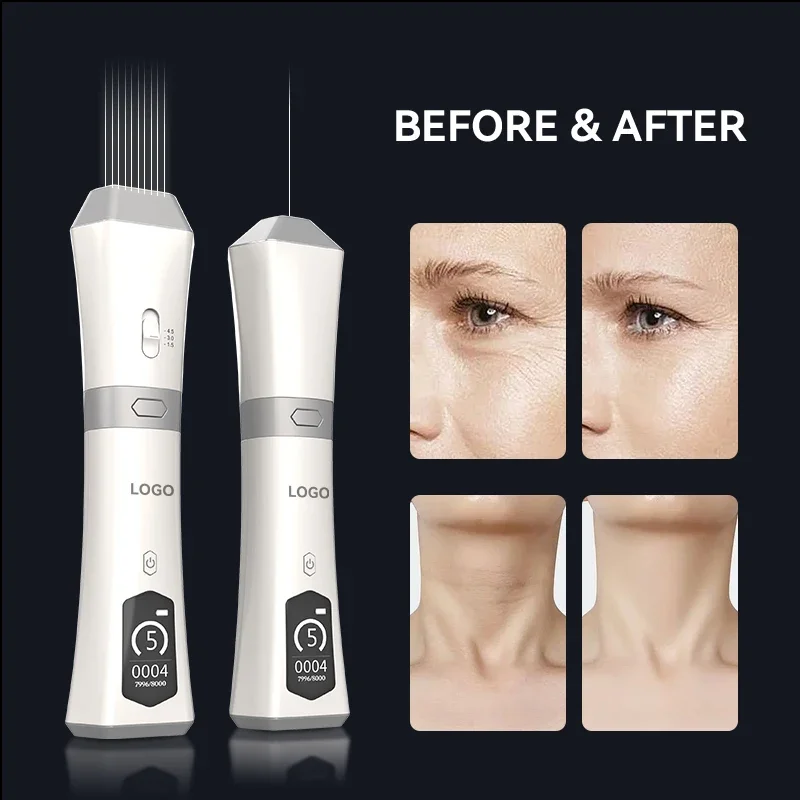 Wrinkle Removal Anti-Aging Multifunctional Device Home Use Facial Lifting Device