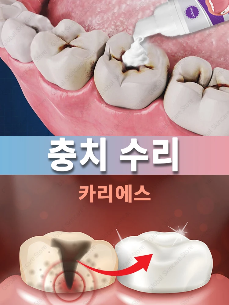 투 디케이 수리