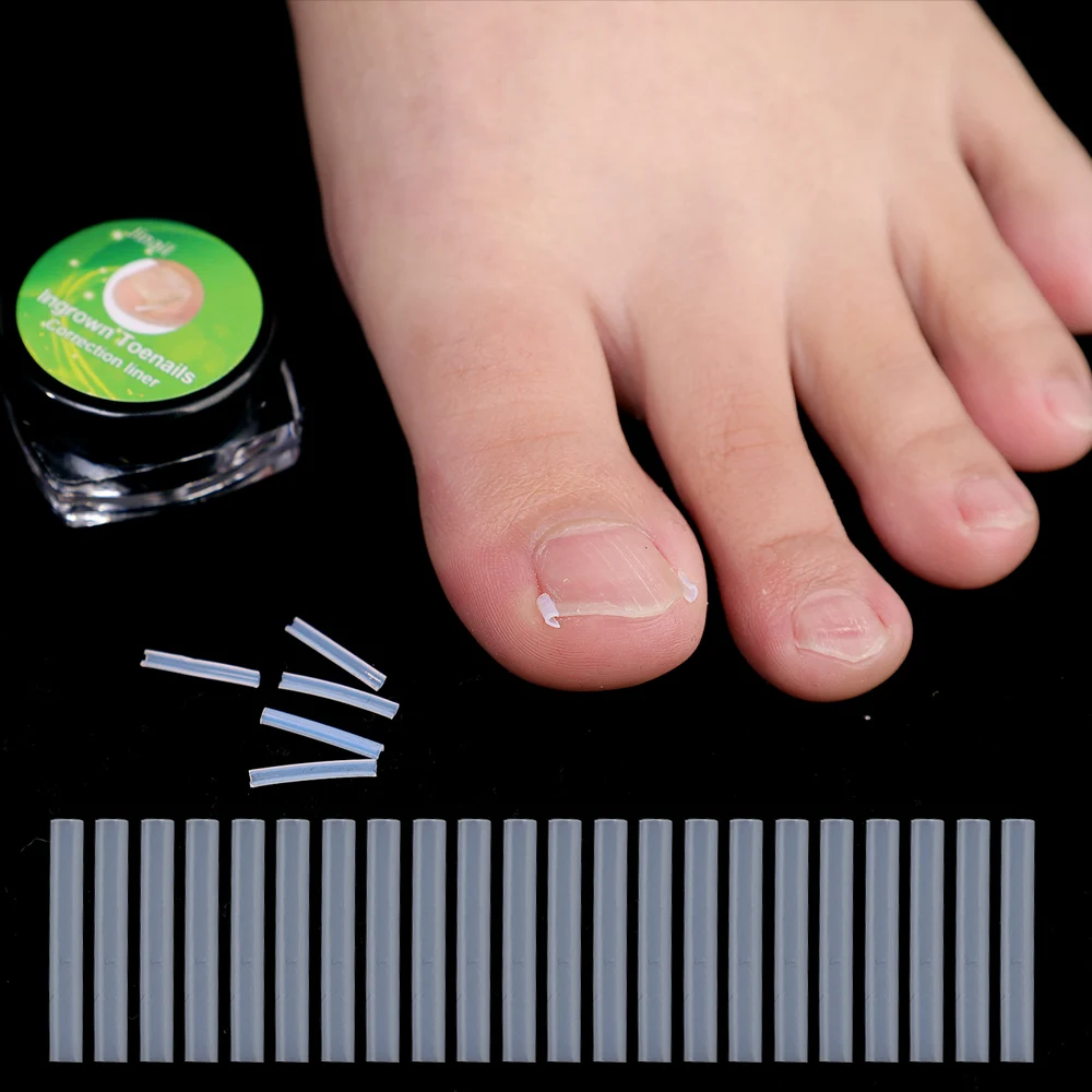 Almohadilla de tubo elástica en forma de C para uñas de los pies, Corrector de uñas encarnadas, herramientas para el cuidado de los pies, tratamiento de Clip alisador de ranura Invisible