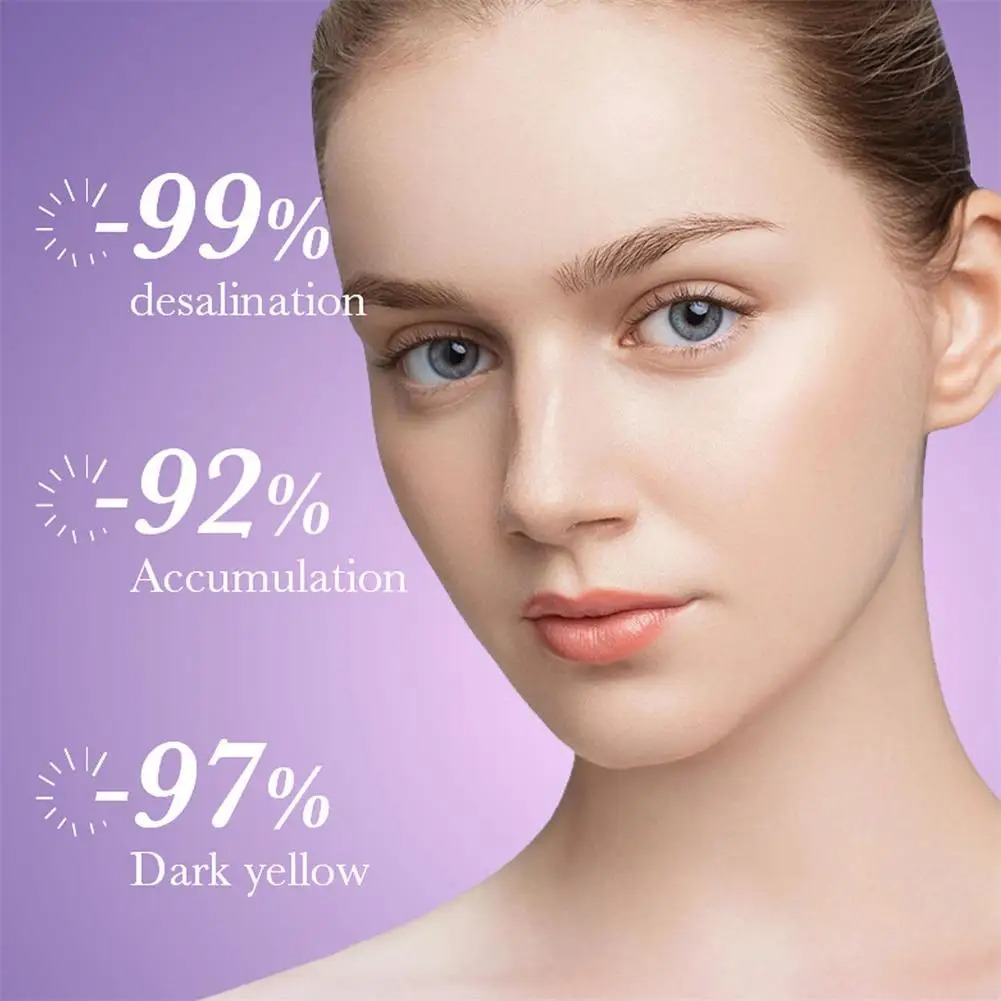 ใบหน้าไวท์เทนนิ่งและครีมลบกระ Nicotinamide Brightening และ Moisturizing Face Cream Fade Dark Spots Cream