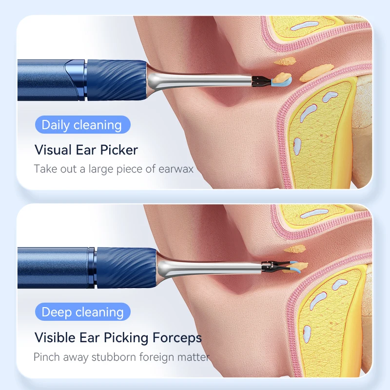 3 in 1 Wi-Fi Enabled Ear Pick Tweezers 12MP Camera Earwax Removal Tool with Rechargeable Battery Ear Cleaner with Tweezers Tools