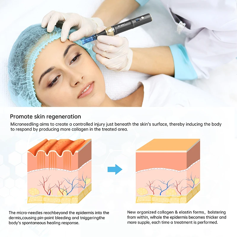 Dr pen a8s sem fio misroneedles derma caneta a8 com 32 peças cartuchos de agulha dr caneta 6 velocidade digital máquina de beleza