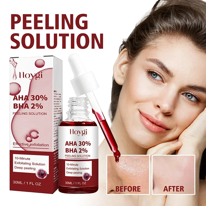 Suero reductor de poros, exfoliante Facial, eliminación de poros grandes, reafirmante, reparación de poros faciales, minimiza la exfoliación efectiva de la piel