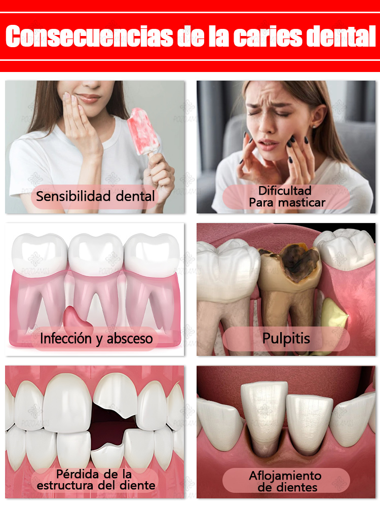 Reparar las caries, eliminar el dolor de muelas, restaurar y blanquear los dientes.