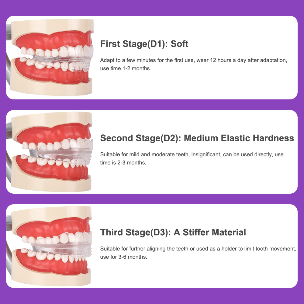 Apparecchiatura dentale a 3 fasi Trainer per denti per adulti Dente Ortodontico Allineamento Brace Correttore trasparente Accessori per dentisti