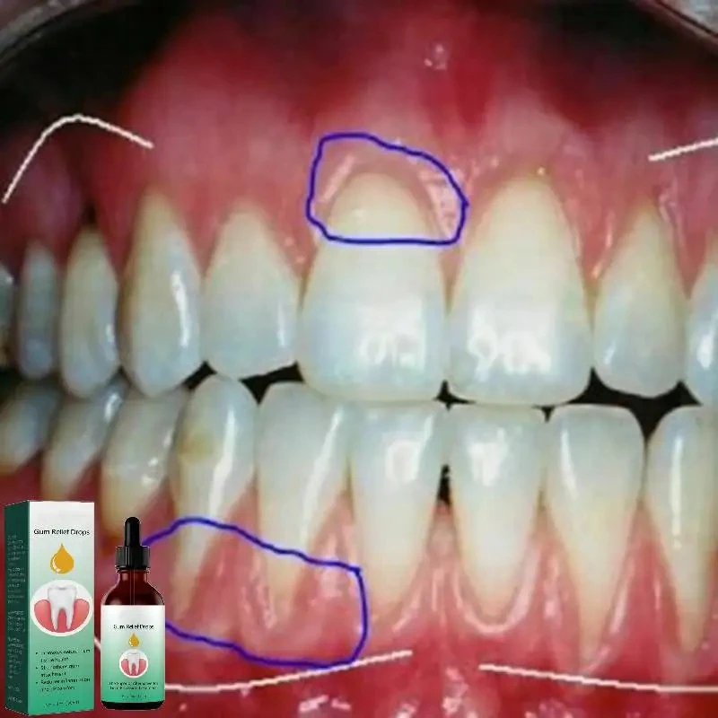 Gum Repair หยดบรรเทาถอนเหงือกบวมหมากฝรั่งทําความสะอาด Oral Periodontal สุขอนามัยลบคราบลบสีเหลือง Tartar