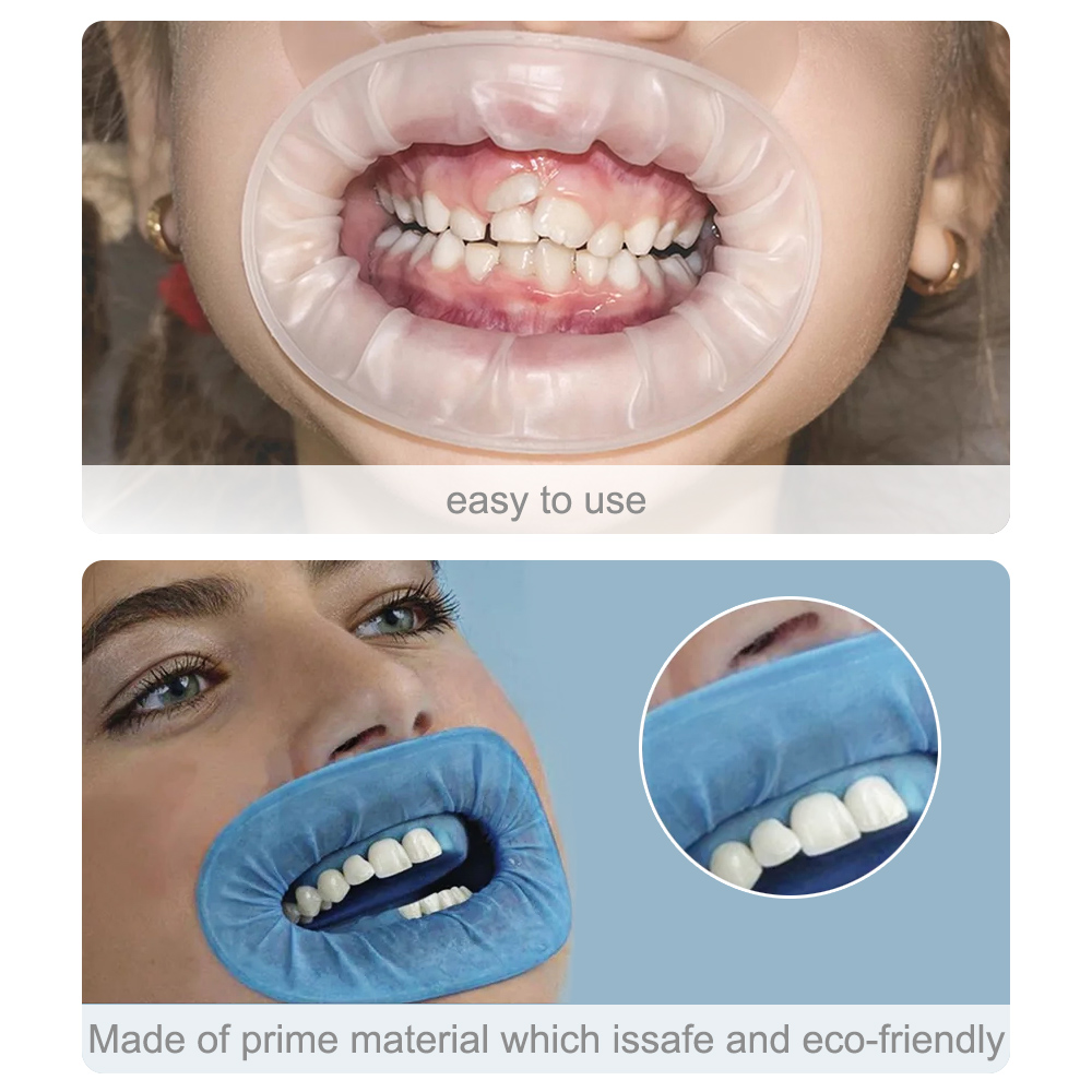 10 ชิ้นทันตกรรมทิ้งยางปราศจากเชื้อเปิดปาก Oral Cheek Expander Retractor ยาง Retractor ยาง Barrier ทันตกรรม