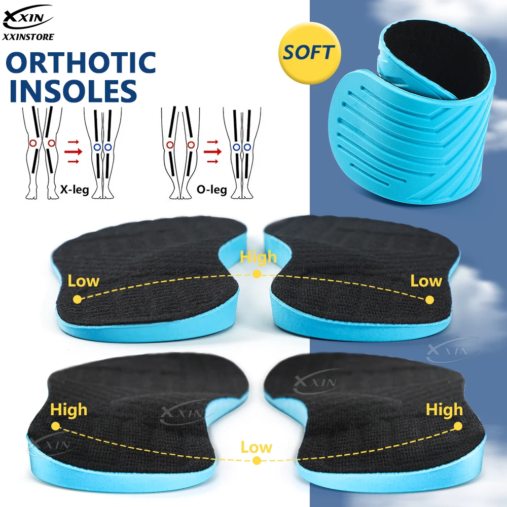 【Xxin】plantillas correctoras de piernas X para hombres y mujeres, almohadillas ortopédicas para zapatos, plantilla para pierna O, inserciones para zapatos de arco plano, talla 35-46