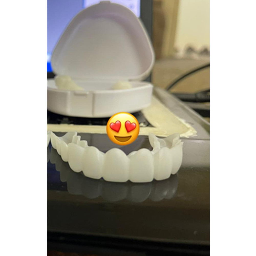 Ultimo Snap on Smile Dentale Superiore Inferiore Denti Finti Copertura Perfetta Impiallacciature Luminose Comfort Fit Flex Protesi Bretelle Sbiancamento