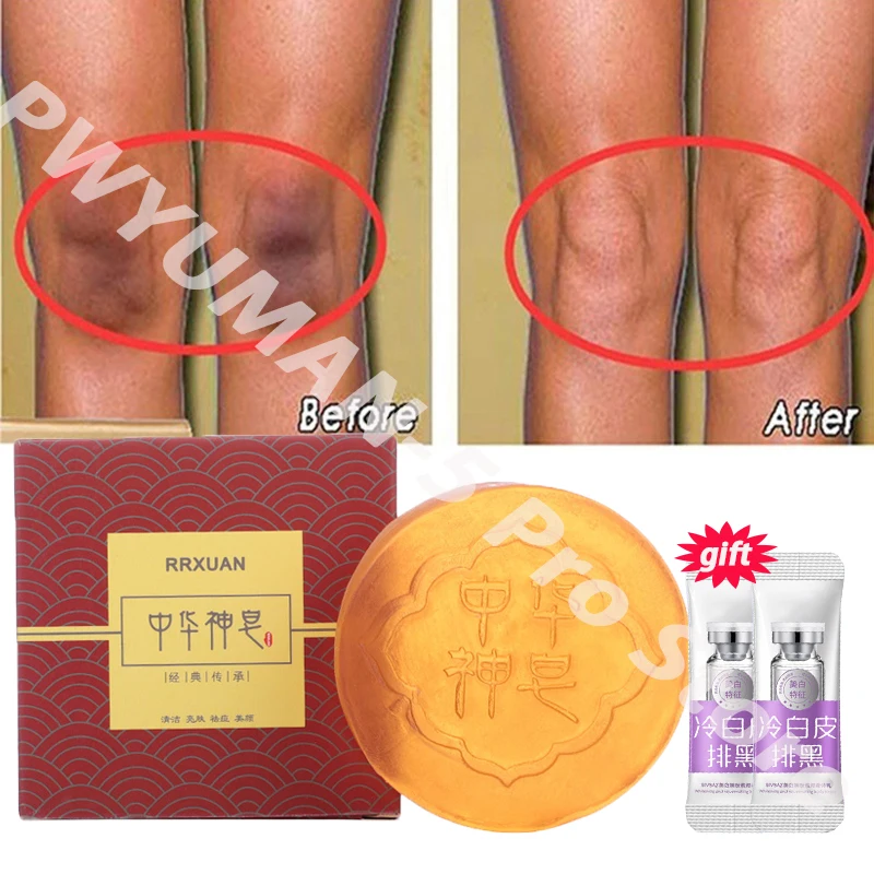 Body Whitening SOAP Deep Clean Skin สบู่กําจัดผิวไก่รักแร้ใต้วงแขนเข่า Bleaching Body Brighten White Care ผลิตภัณฑ์
