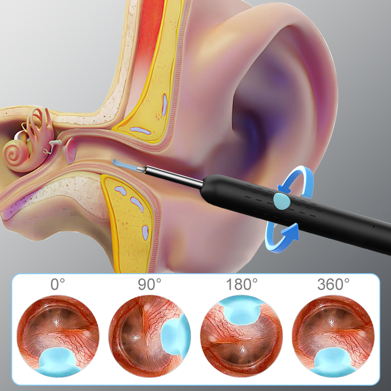 Visual Wireless Endoscope 4.2mm HD 1080P Camera for iOS/Android WiFi Otoscope Ear Picker for Ear Cleaning Skin Health Check