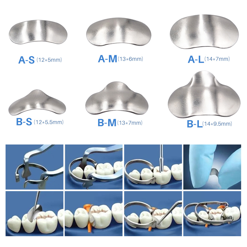 100 unids/bolsa matrices dentales bandas de matriz de Metal contorneadas seccionales anillos de matriz reemplazo completo de dientes herramienta de cuidado bucal Dentsit