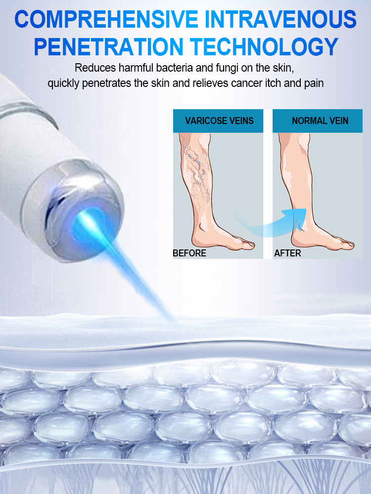 Hot Selling Laser Vein