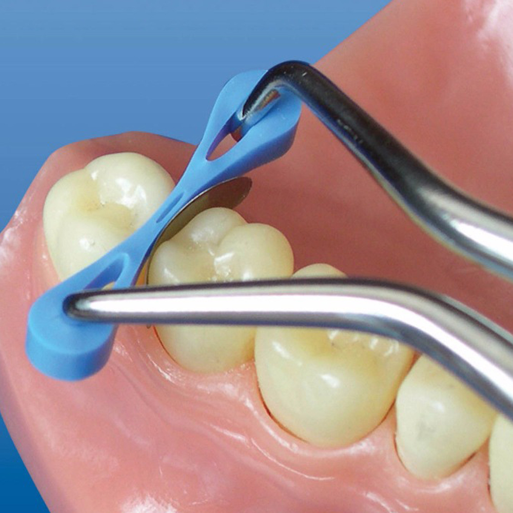 Cuñas de fijación de goma elástica Dental, matrices de matriz, separador de dientes compuesto, herramientas accesorios de odontología, 60 uds.